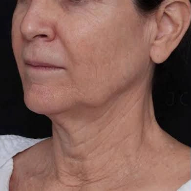 AxD 01-(Compressify.io)