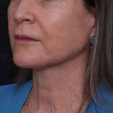 AxD 01-(Compressify.io)_1