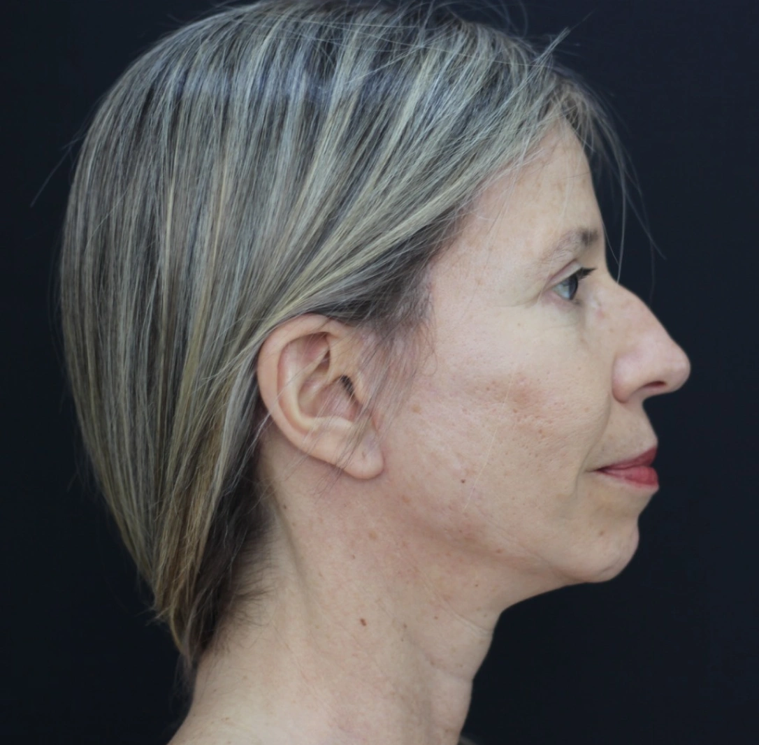 AxD 02-(Compressify.io)